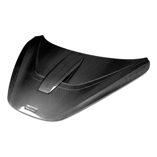 MATTS McLaren 720S front hood NVT package